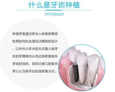 什么是牙齿种植