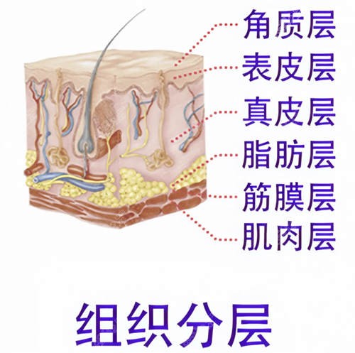 面部下垂皮肤真层模拟图