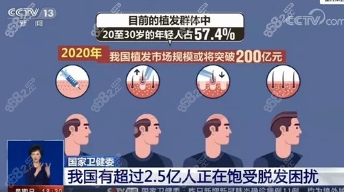 你脱发吗?发际线自救干货-附北京唐道臣植发前后案例效果图
