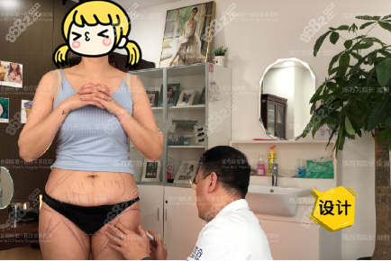 陈万芳吸脂手术设计中