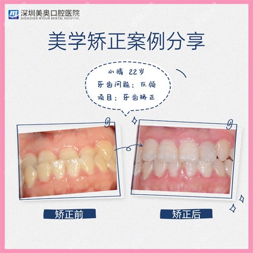 深圳美奥口腔牙齿矫正<span style=