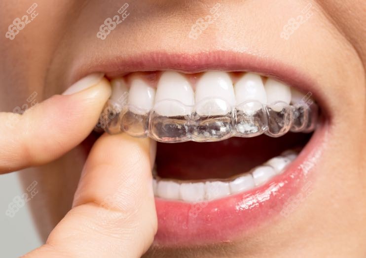 贵州六盘水做种植牙,牙齿矫正价格是多少 5千以下有啥品牌