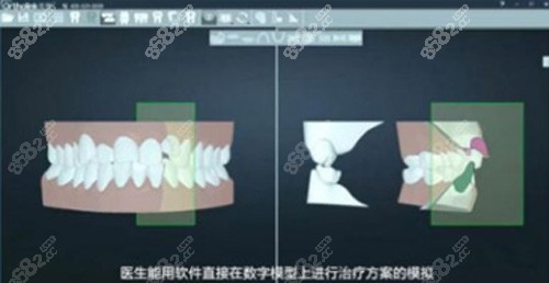 重庆维乐口腔数字化牙齿美学矫正