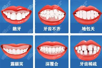 哪些情况需要牙齿矫正