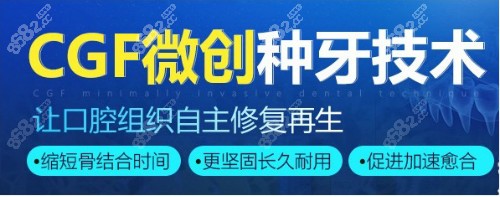 无锡做奥齿泰种植牙