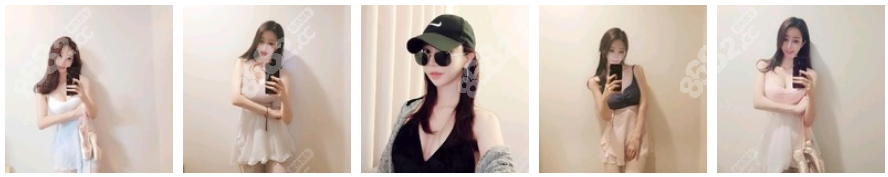 南京华美赵广生隆胸案例反馈