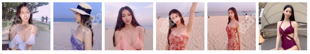南京华美赵广生假体隆胸案例