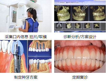在拜博口腔做种植牙的步骤