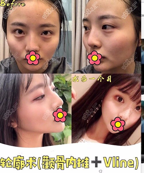 金一秀做的磨骨怎么樣