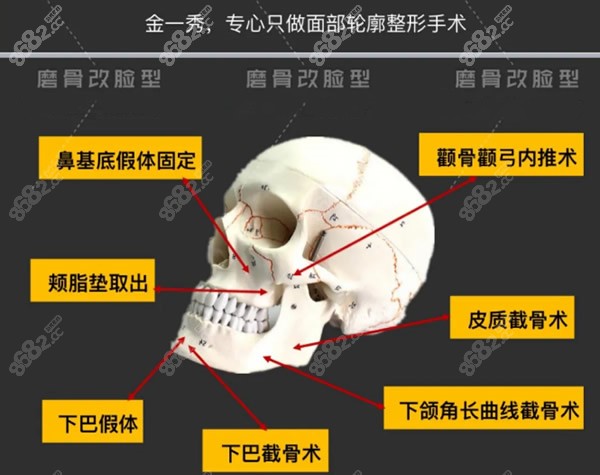 金一秀醫(yī)生擅長的項目