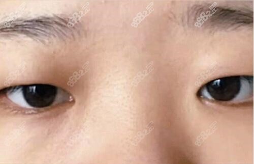 术前照片