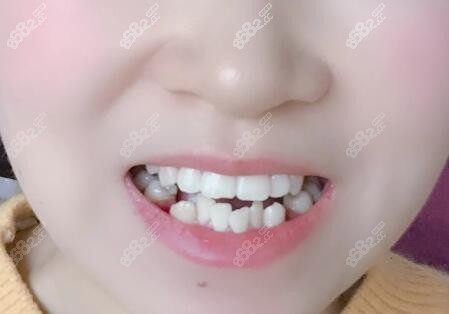 北京拜博口腔牙齿矫正价格