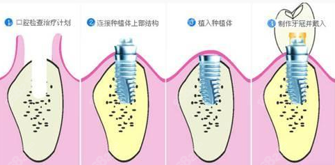 上海美奥矫正牙齿怎么样？
