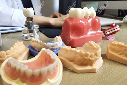 昆明牙齿矫正牙具模型