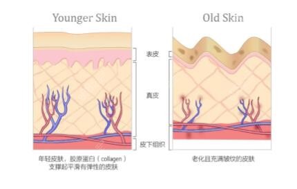 水剥离除皱做一次的价格多少钱