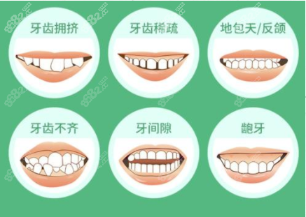 上海牙齿矫正哪家好？