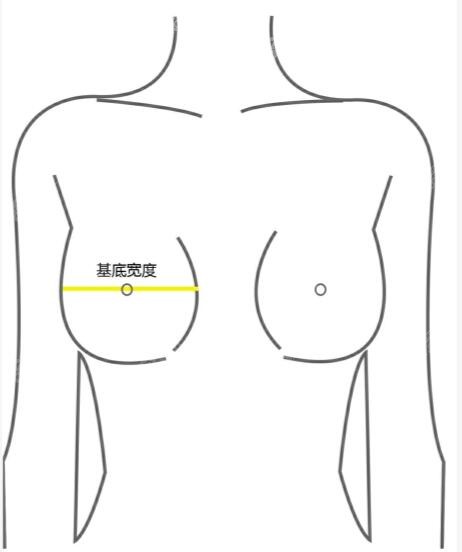 假体隆胸220是多大罩杯