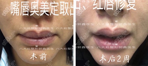北京<!--<i data=20240705-sp></i>--><!--<i data=20240705-sp></i>-->取奧美定真人案例