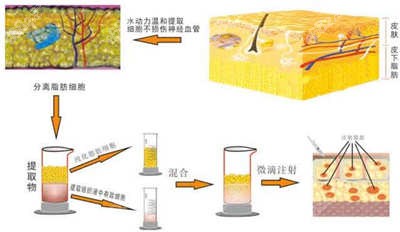 面部填充过程