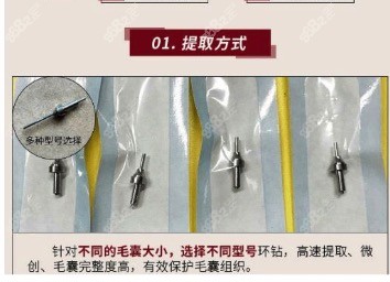 为啥在春天植发比较好？乌鲁木齐植发医生杨金梅帮你解答