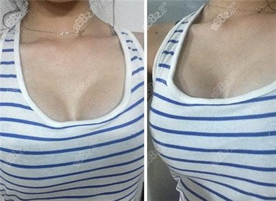 龍口悅己整形隆胸<span style= 龍口悅己整形隆胸<span style=