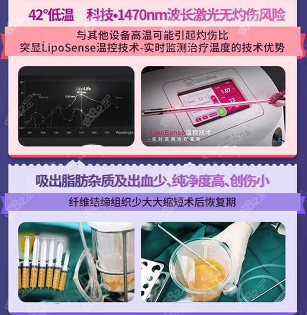 北京雅靓5G天使光雕全身吸脂