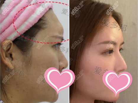 <!--<i data=20240705-sp></i>-->取生长因子案例图2