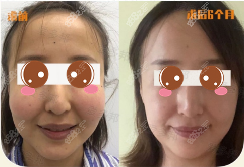 <!--<i data=20240705-sp></i>-->取生长因子案例图1