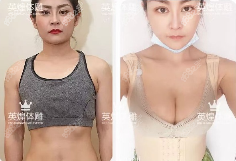 北京英煌梁耀婵微脂丰胸<span style=