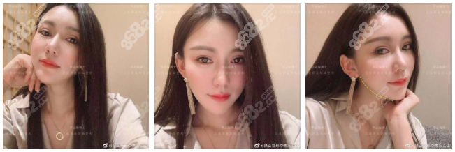 上海华美李志海磨骨效果有保障