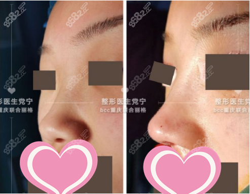 重庆联合丽格党宁耳软骨鼻综合案例图