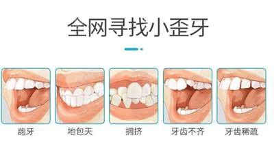 哪些牙齿情况需要矫正