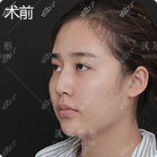 我做鼻子前