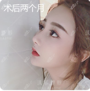 刘彦军做鼻子一点不夸张