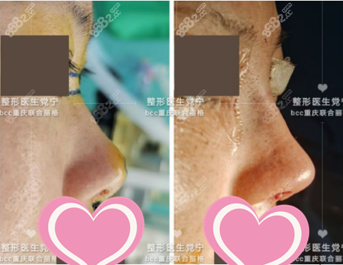 重庆联合丽格党宁鼻综合案例图