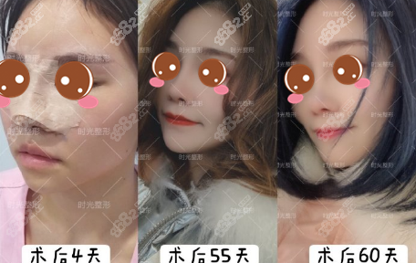 重庆时光鼻综合案例图