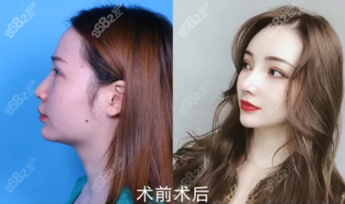 侧面照片