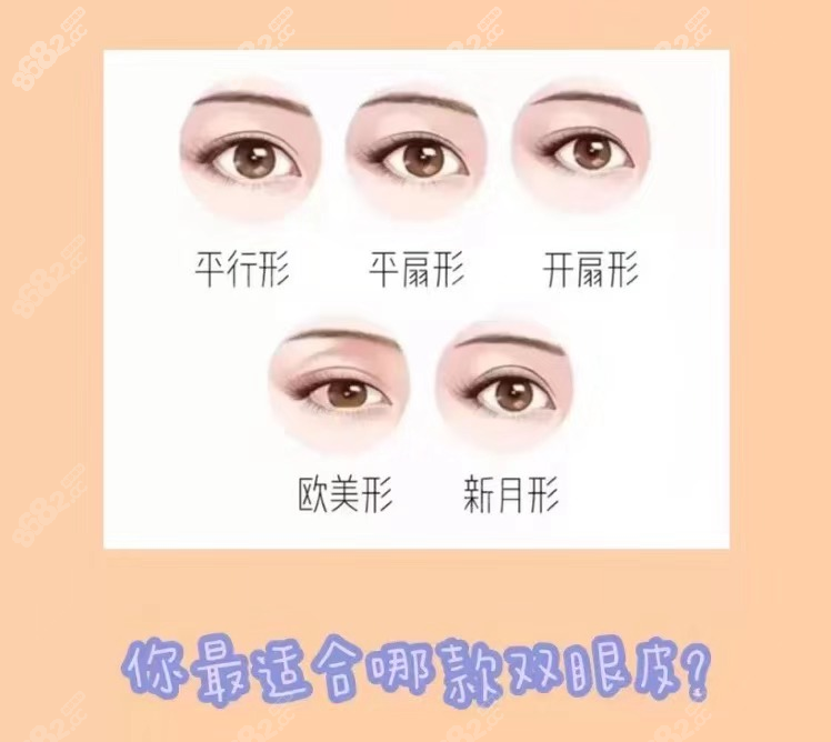 几种常见的双眼皮形态