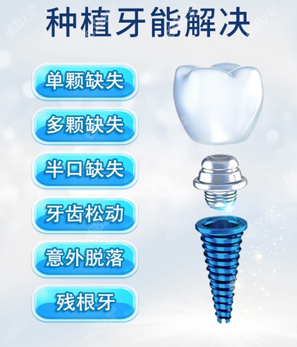 上海鼎植口腔种植牙技术