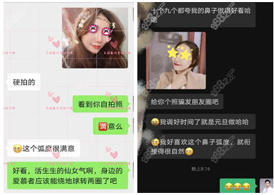 其他顾客找姬医生做的鼻子反馈参考