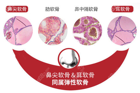 三大传统软骨结构