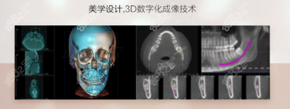 上海美联臣磨骨有3D数字化成像技术