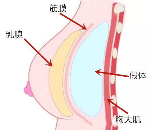 筋膜层丰胸的位置