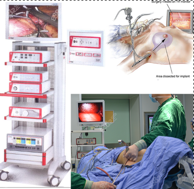 广州曙光内窥镜隆胸技术