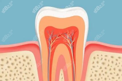 牙齿根管治疗后牙齿的寿命是多长呢