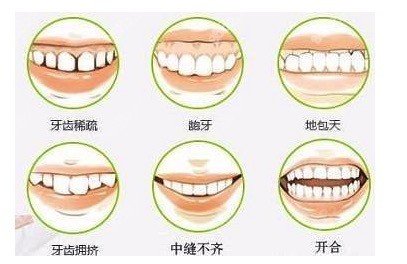 儿童牙齿畸形