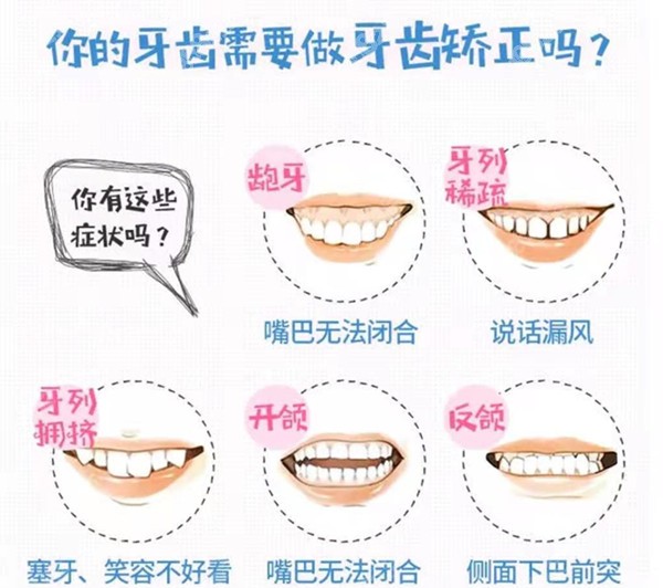 需要做牙齿矫正的牙齿类型