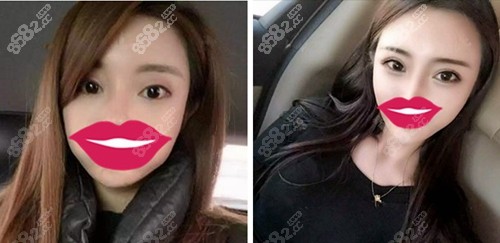 北京画美徐学东眼综合案例