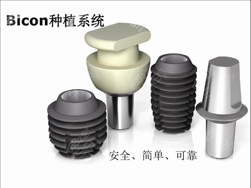 美国百康bicon种植牙