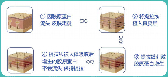 密拉提提升的原理